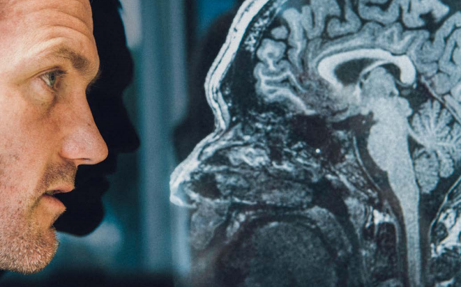 Professor Stuart Grieve comes face to face with an MRI image of himself.