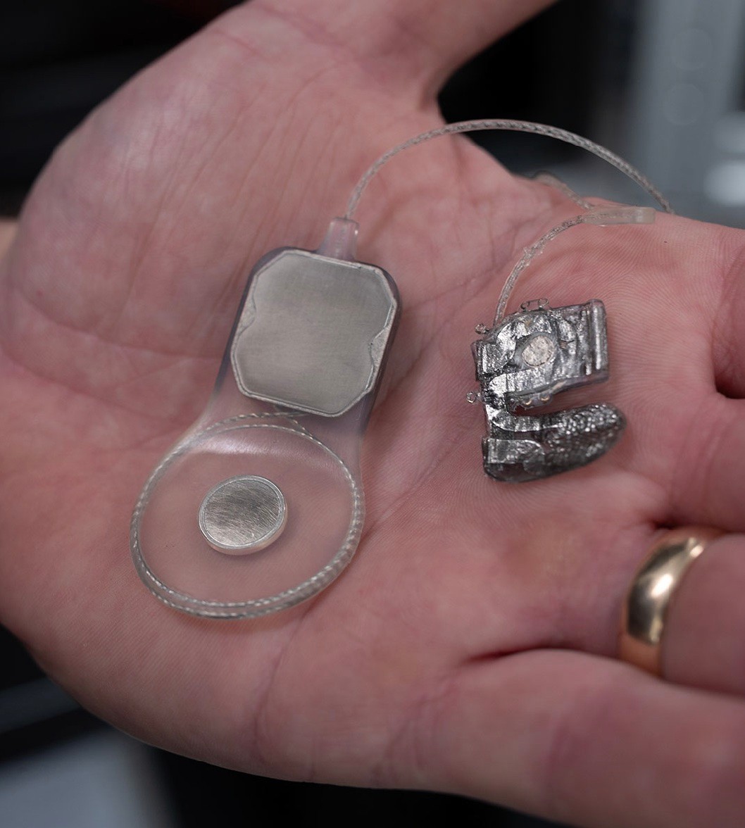 photo of an open hand with the small components of the bionic eye sitting on the hand