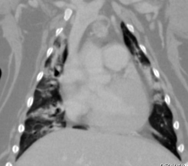 Computed tomography or CT of a dog chest.