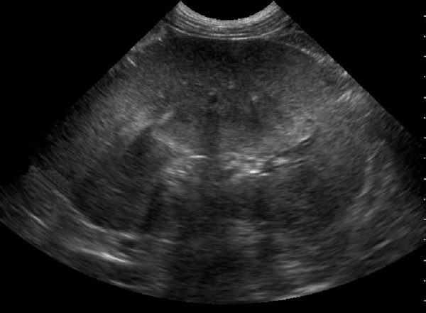 Ultrasound depicting a canine kidney.