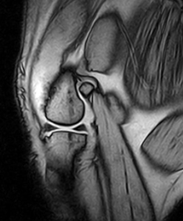 MRI image of a dog's left stifle.
