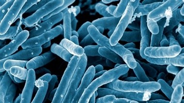 Tuberculosis bacteria.
