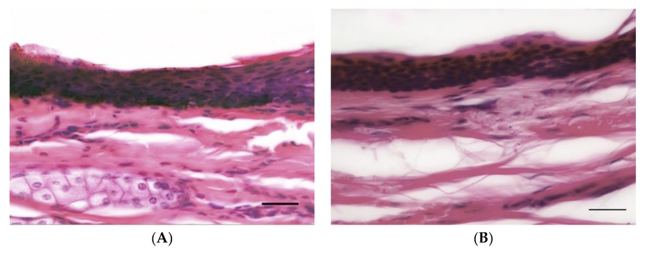 Close-ups of horse skin and human skin.